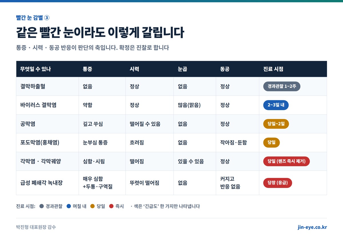 빨간 눈 응급 감별 - 결막하출혈과 급성 폐쇄각 녹내장, 각막염, 포도막염, 공막염, 안구 외상의 통증 시력 눈곱 동공 비교