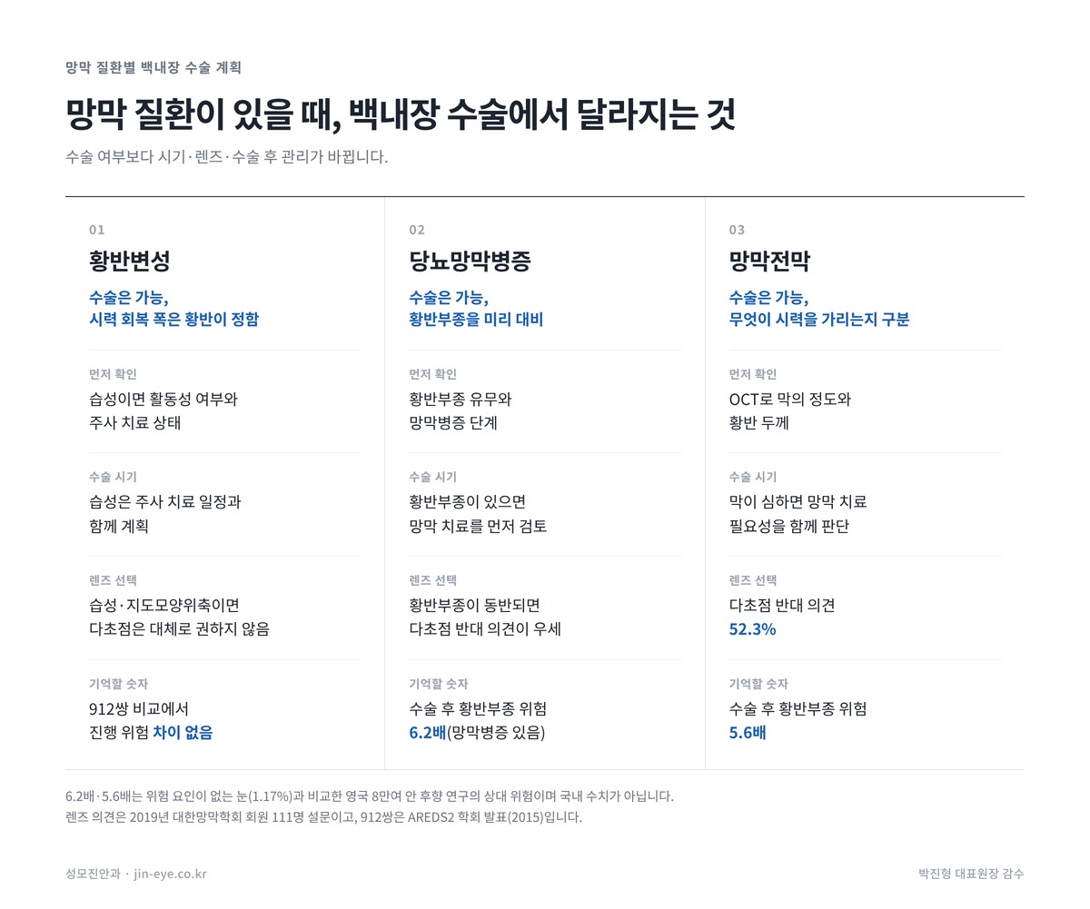 백내장 수술 전 망막 검사 결과에 따른 수술 계획 — 황반변성, 당뇨망막병증, 망막전막별 먼저 확인할 것과 렌즈 선택