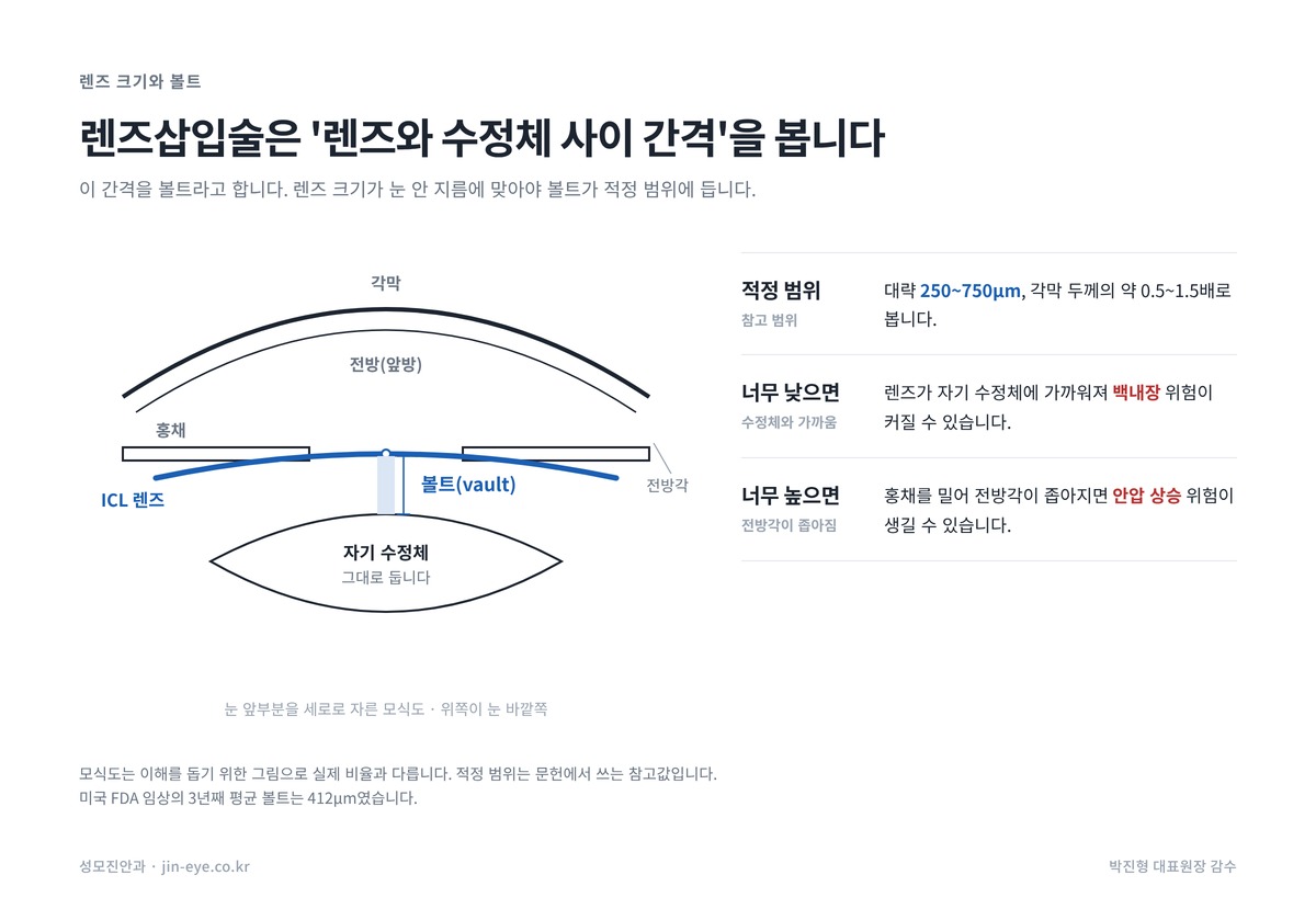 렌즈삽입술 볼트 모식도 — 홍채 뒤 ICL 렌즈와 자기 수정체 사이 간격, 적정 범위 250~750μm, 너무 낮거나 높을 때의 위험